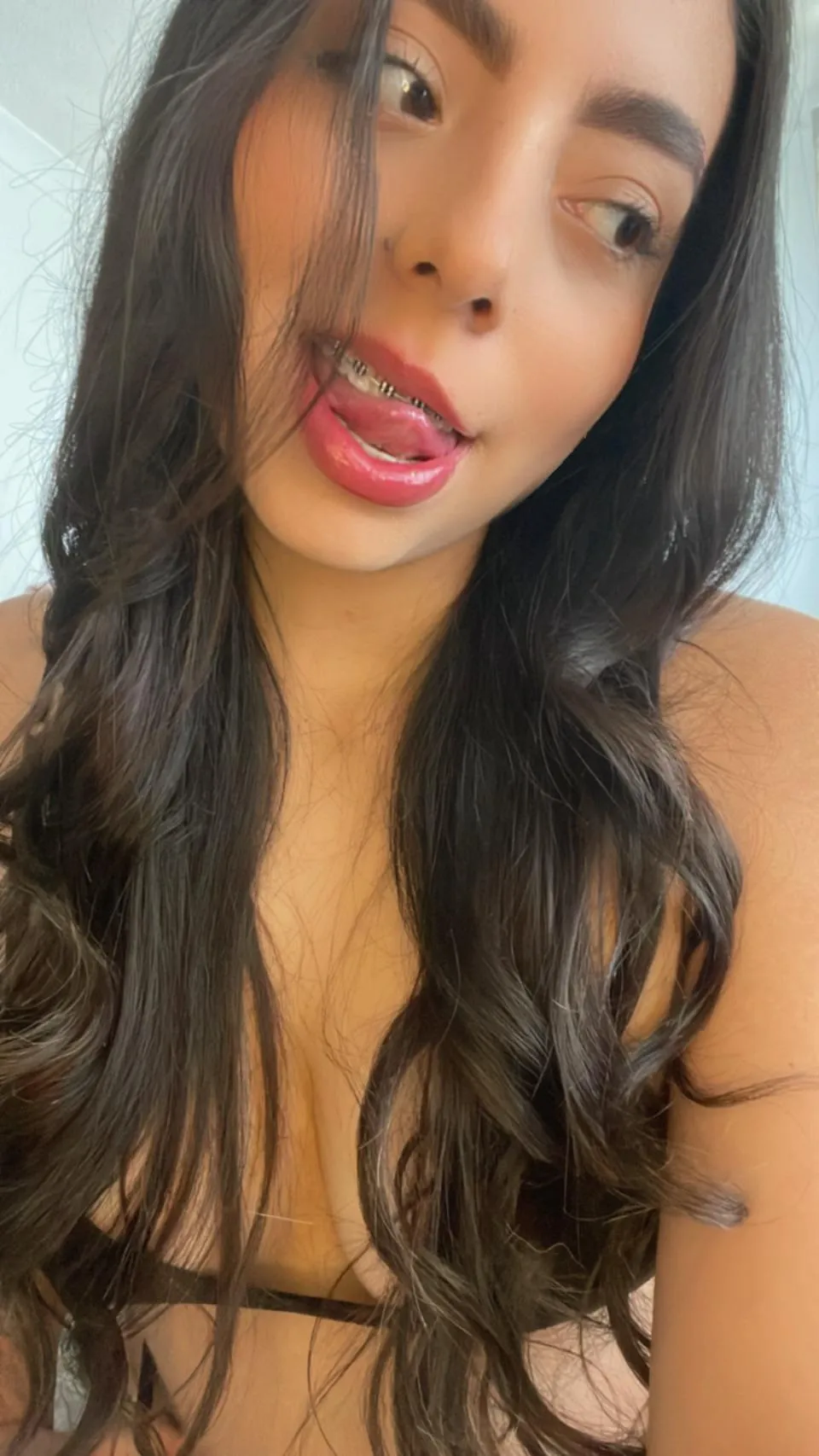 Would you take my braces?