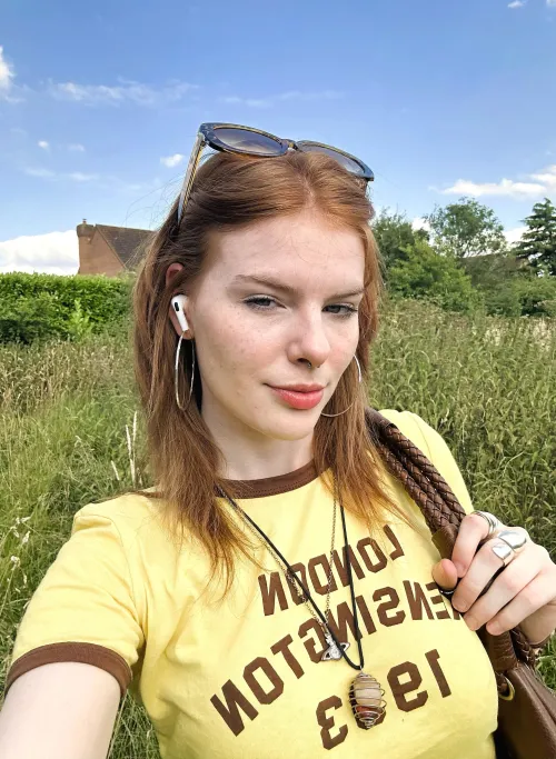 Does my freckles look good on me? [IRTR]