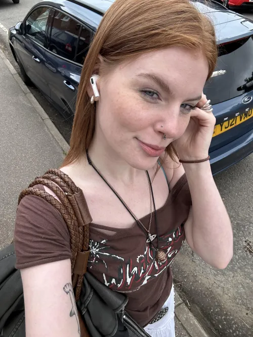 Do you like my freckles?