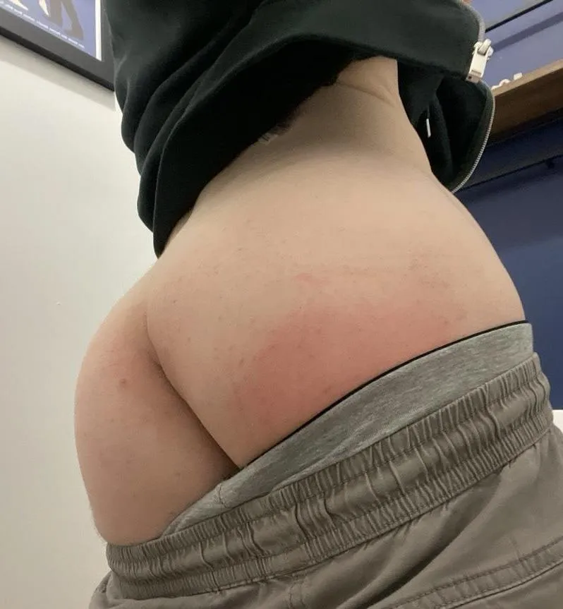 [18] here’s this since it’s all i’m good for