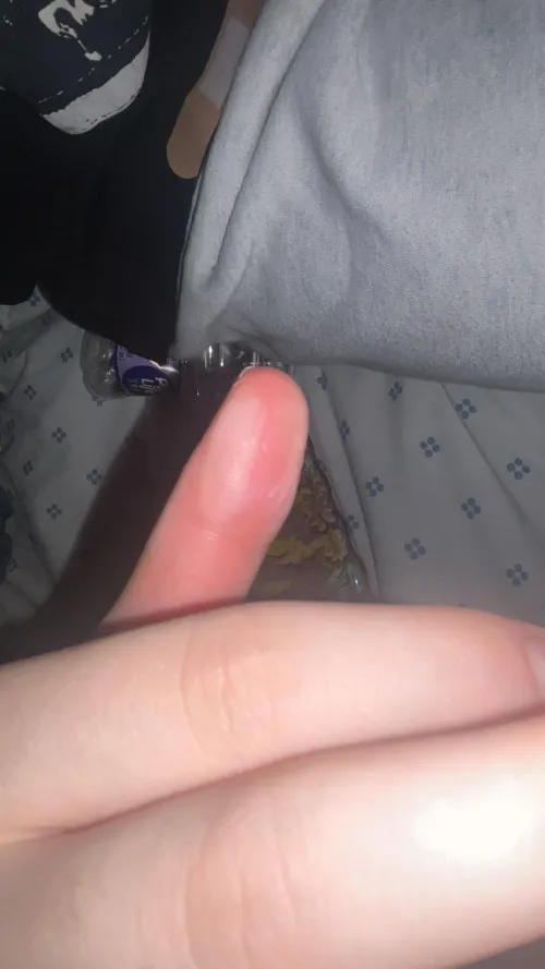 Burn advice? grabbed my hair straightener on 450 degrees because i thought it had automatically turned off.