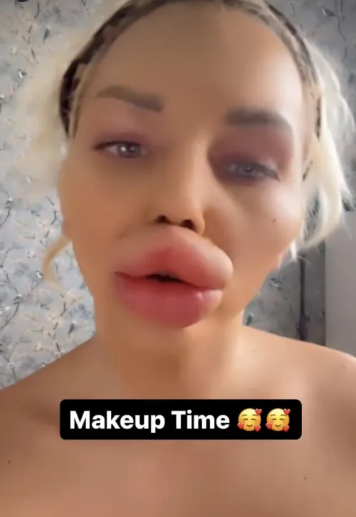 Honestly though the lips were prosthetics, they're not.