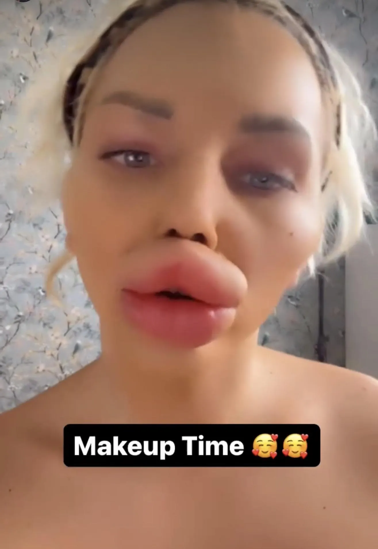 Honestly though the lips were prosthetics, they're not.