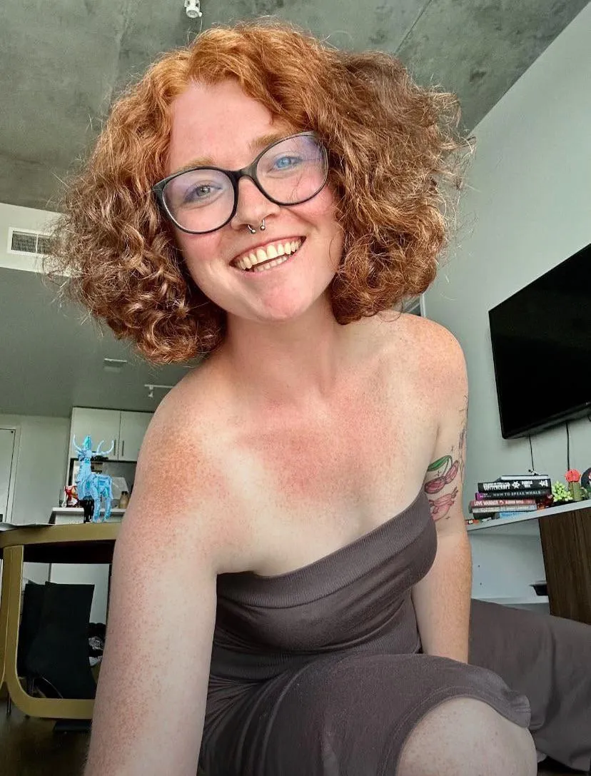 [IRTR] Summer brings out the freckle tanlines…