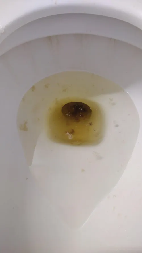 Pain in my side, and my poop has been coming out like this for at least a month now