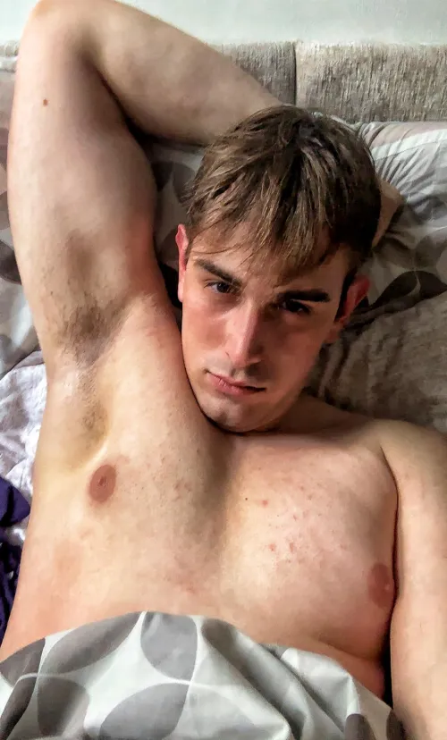 You wouldn’t believe the strong smell on these pits!