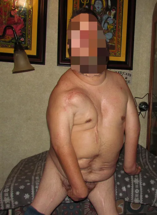 what do you think of my scars