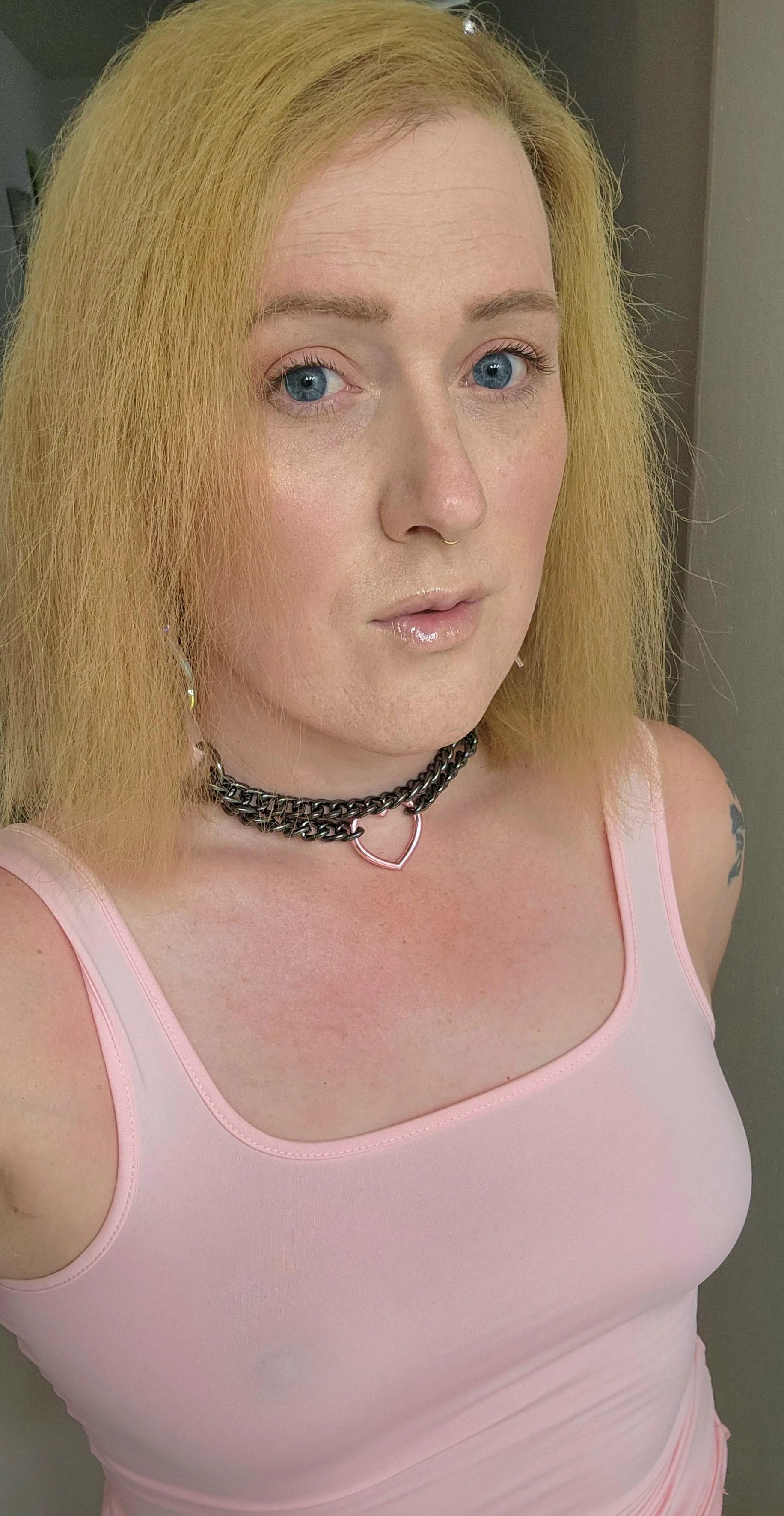 1 syringe of restylane