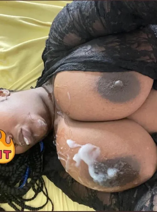 How to treat chocolate tits