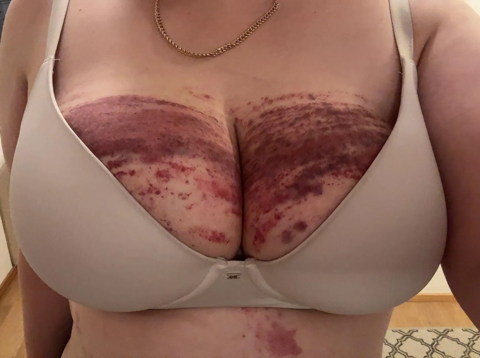 Got me good on the tits