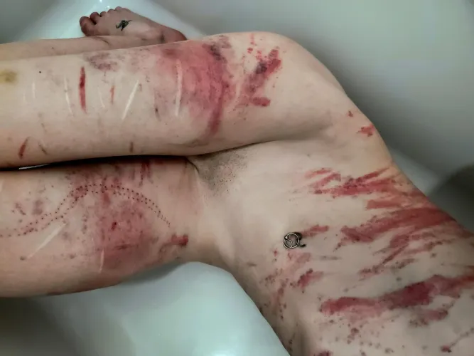 Some marks from a scene last night!