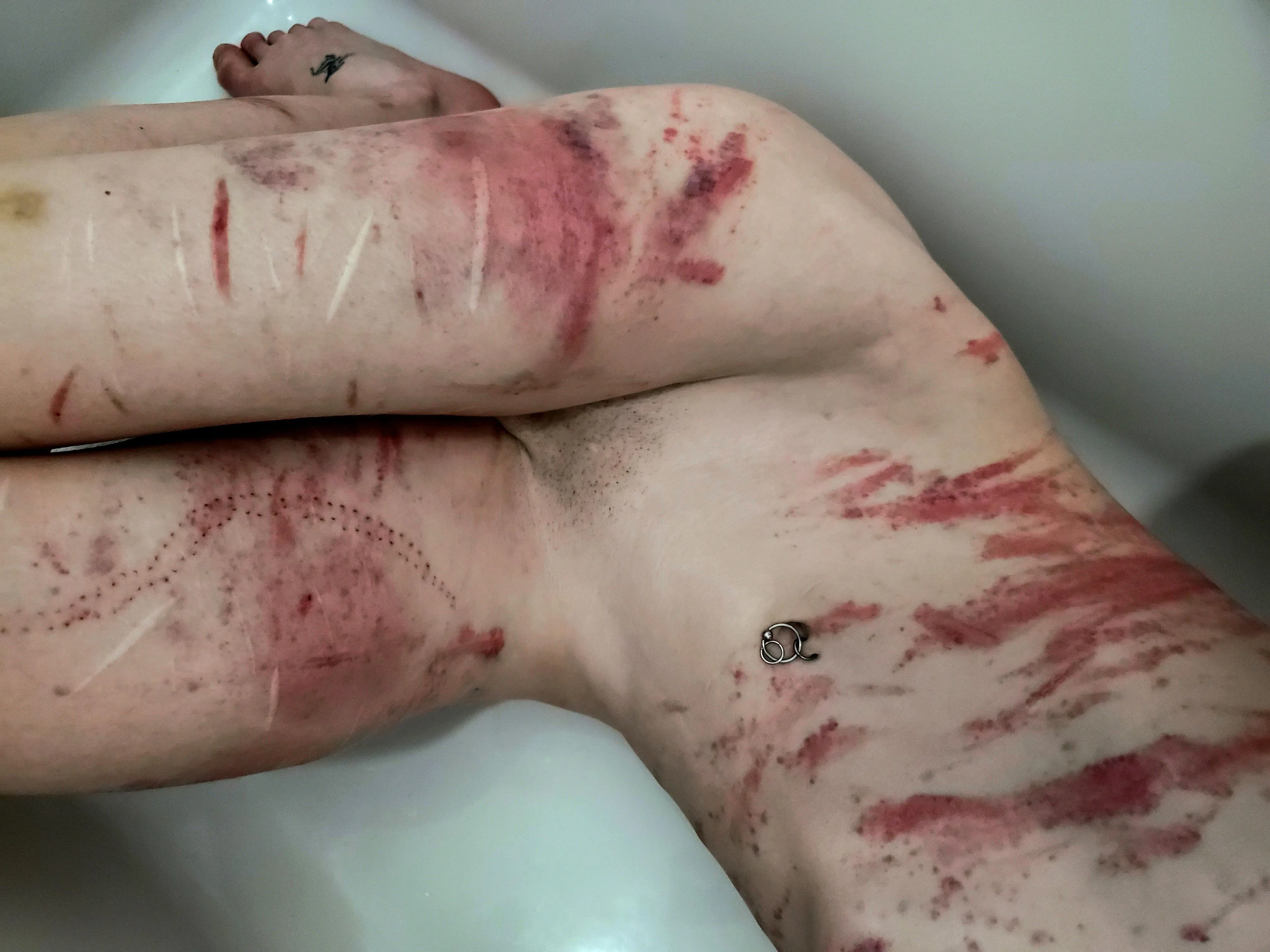 Some marks from a scene last night!