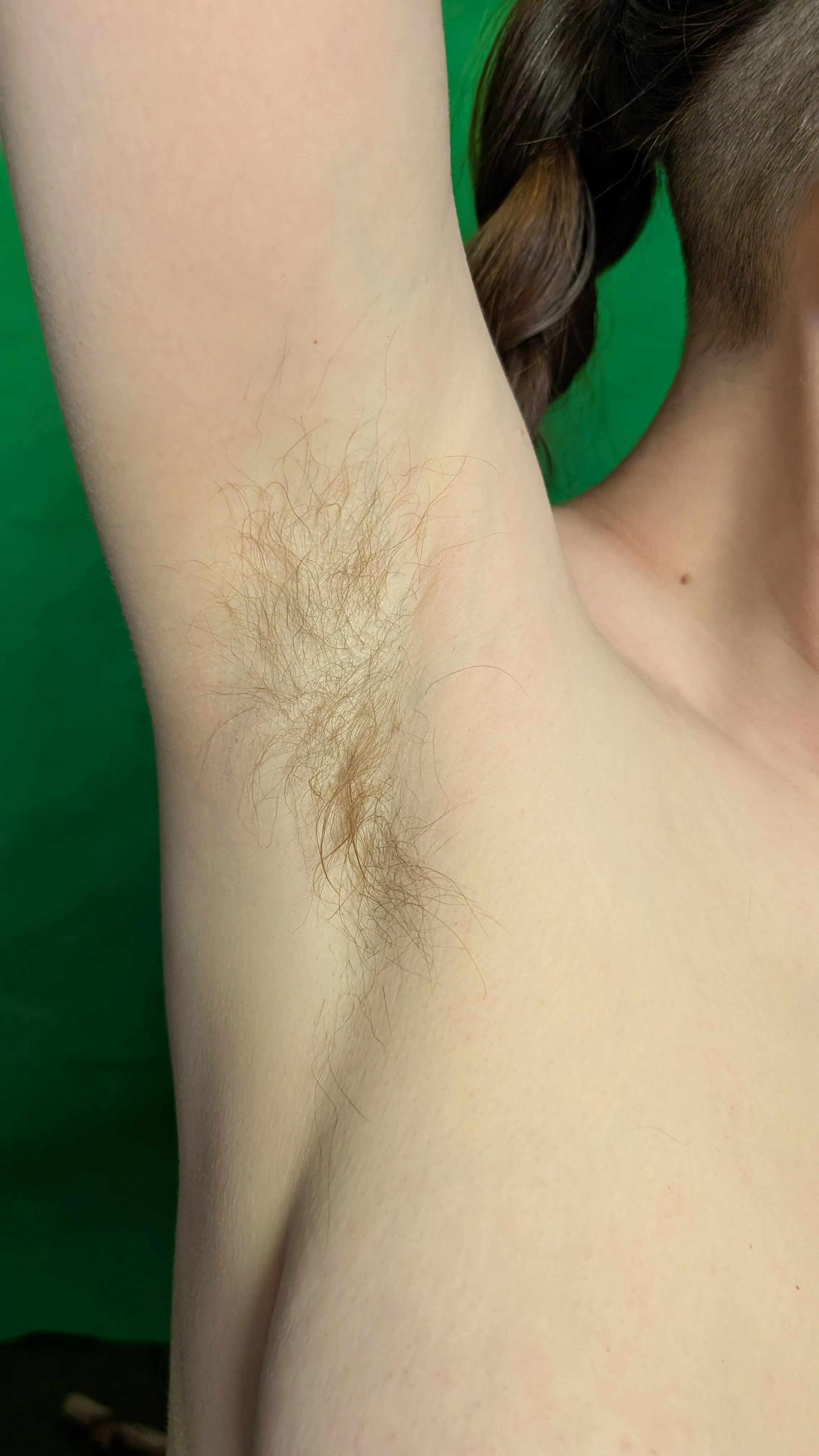 Sweating in a hot day [p]