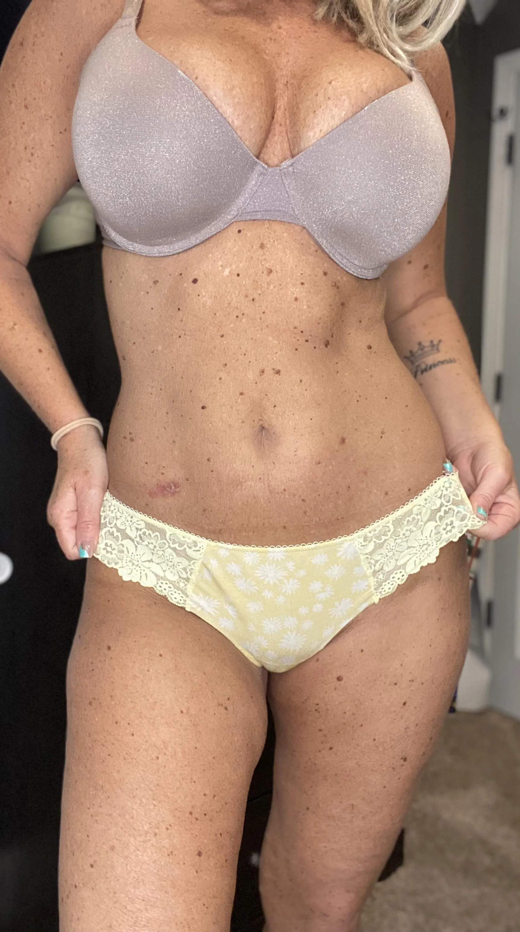 Sun brings out these freckles