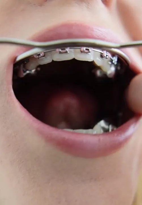 Cute lil’ pink bands