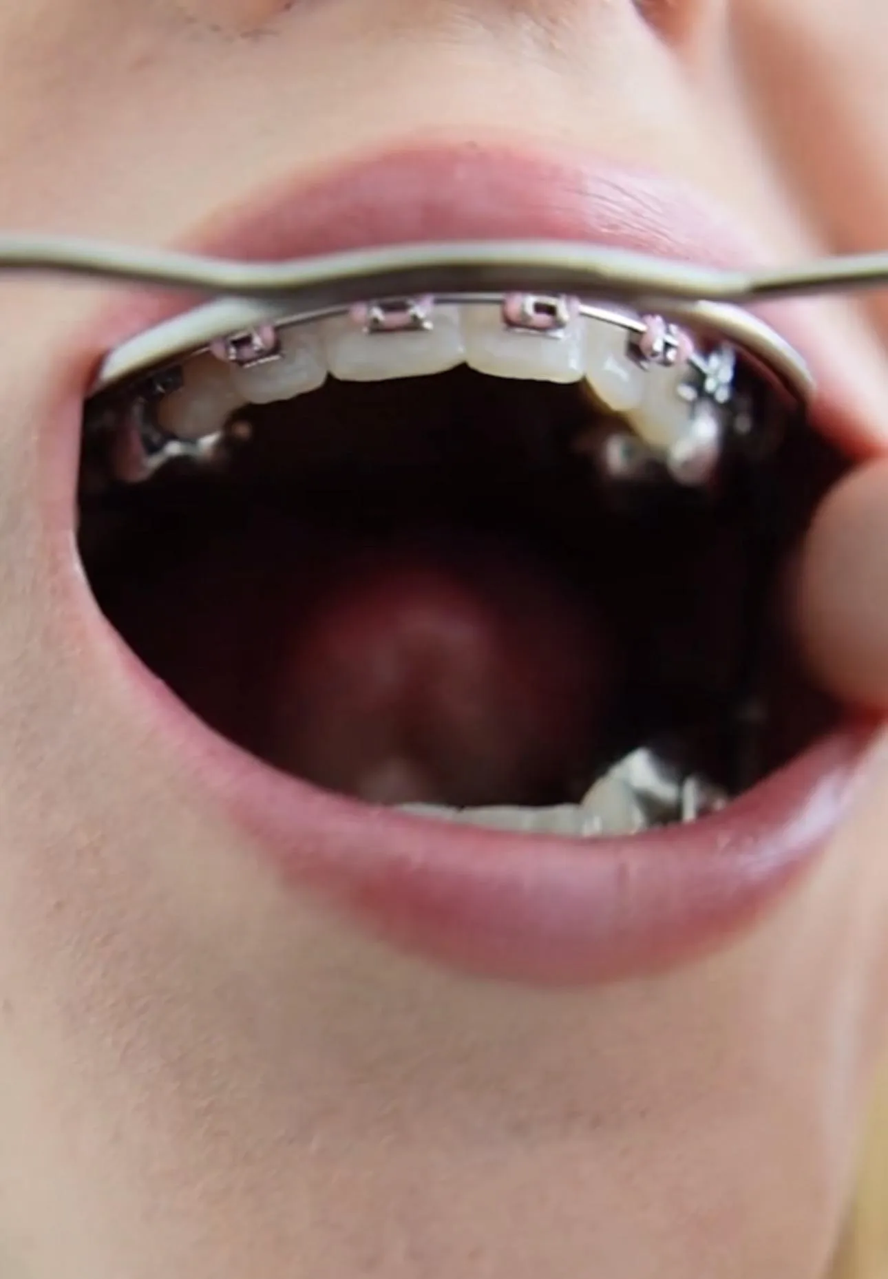 Cute lil’ pink bands