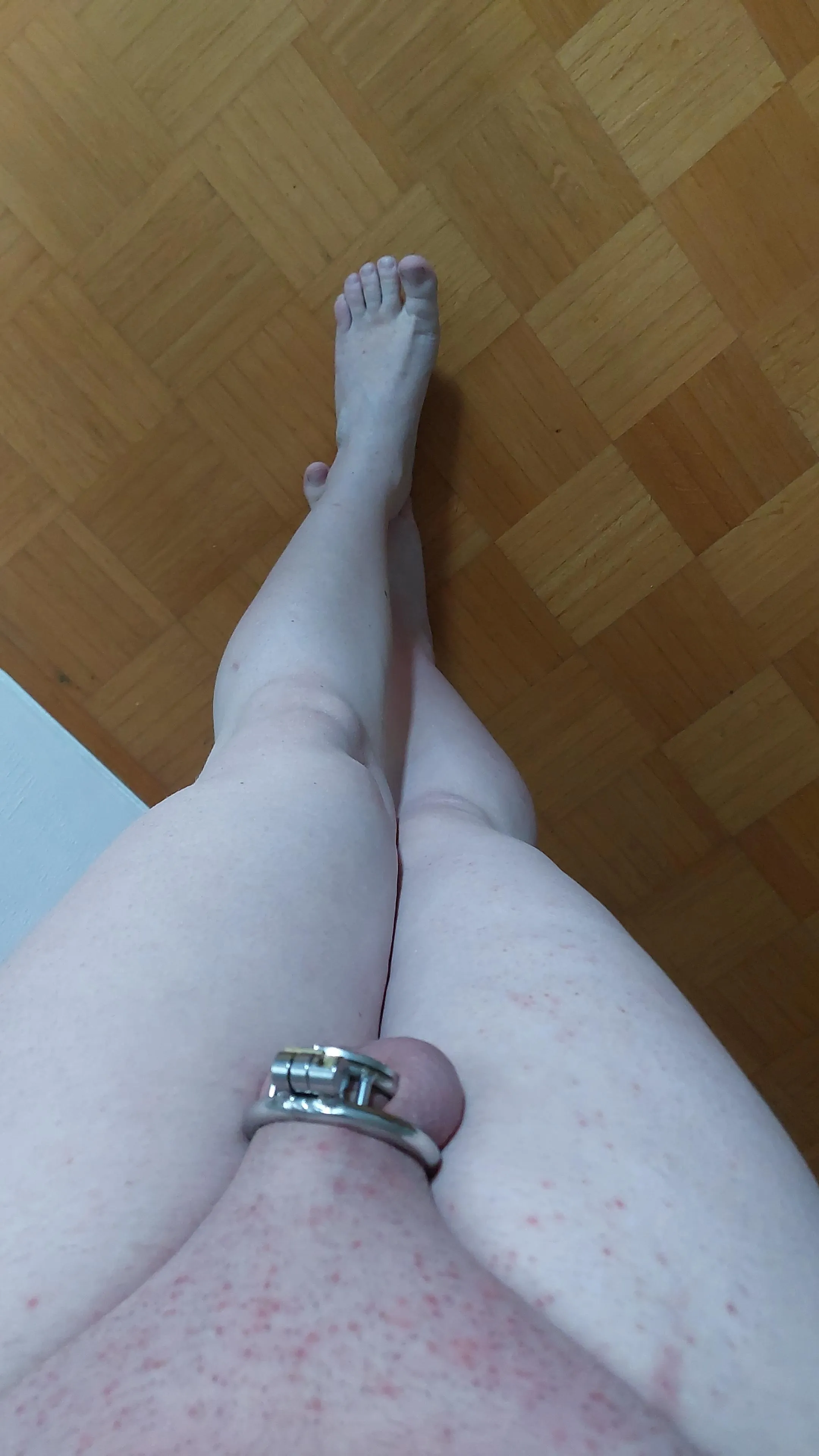 Pale skin and flat cage 💕