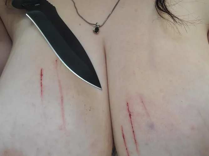 💖 bruises are pretty I wish it was bigger