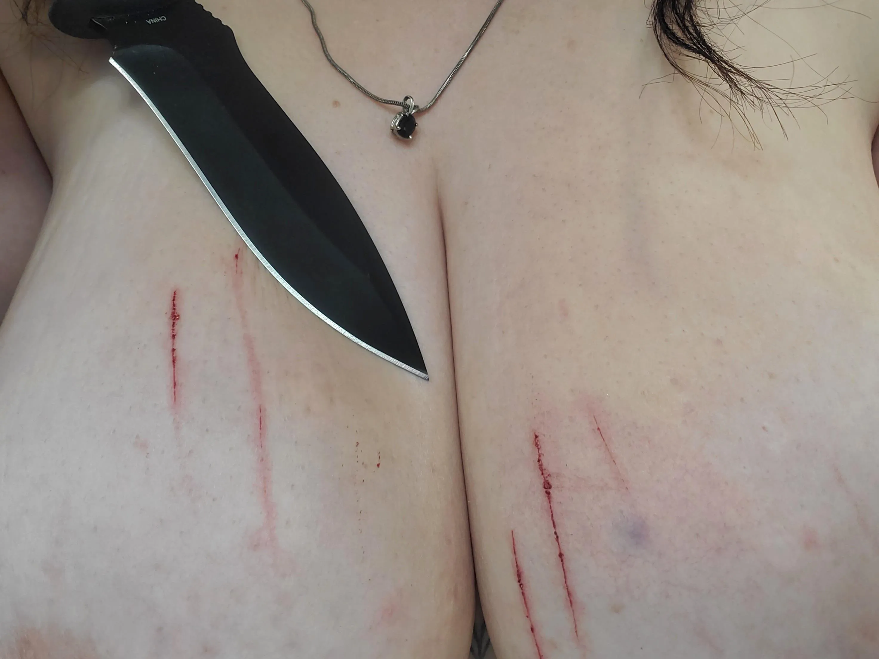 💖 bruises are pretty I wish it was bigger