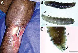 Aftermath of a flesh-eating screwworm infection. This parasite was eradicated from the US in the 60s but may be reemerging(more info in comments)