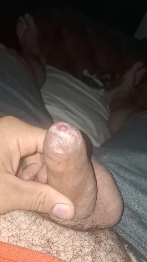 Its tight doesn't go down i have phimosis