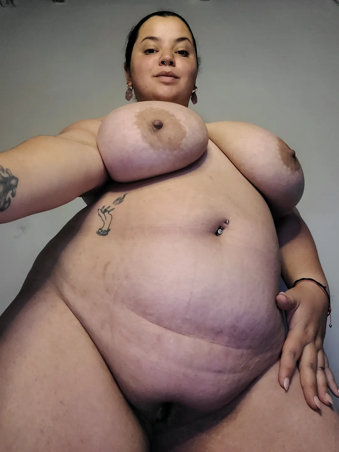 My stripes, my unique beauty