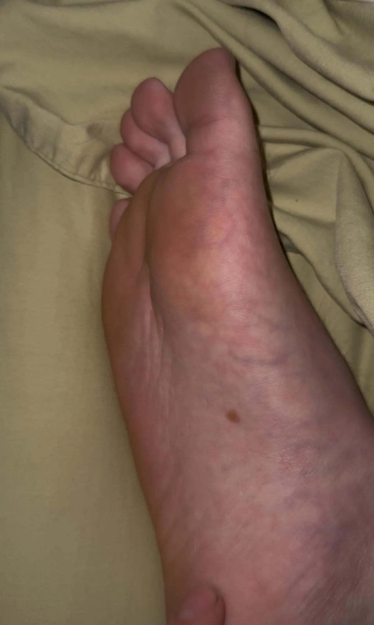 Dm for full sleepy feet video