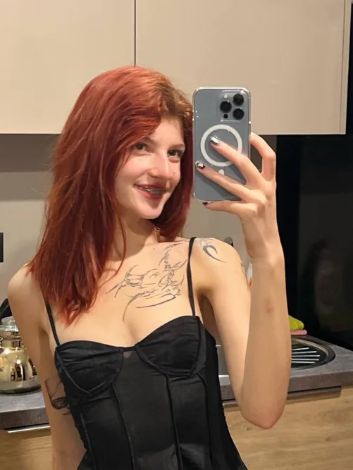 braces, ink, and girl math : this counts as personality right?