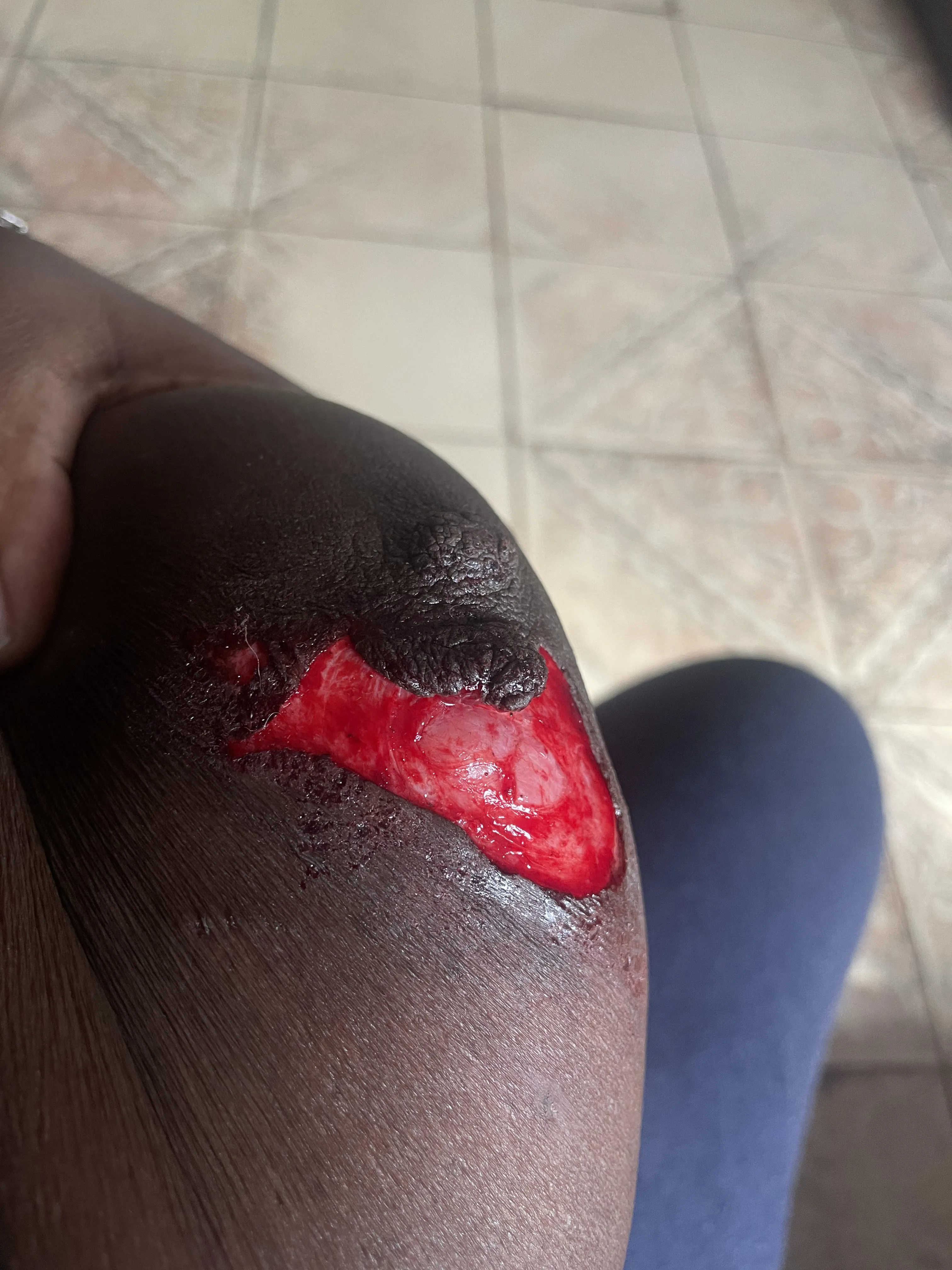 A random dog bit me today