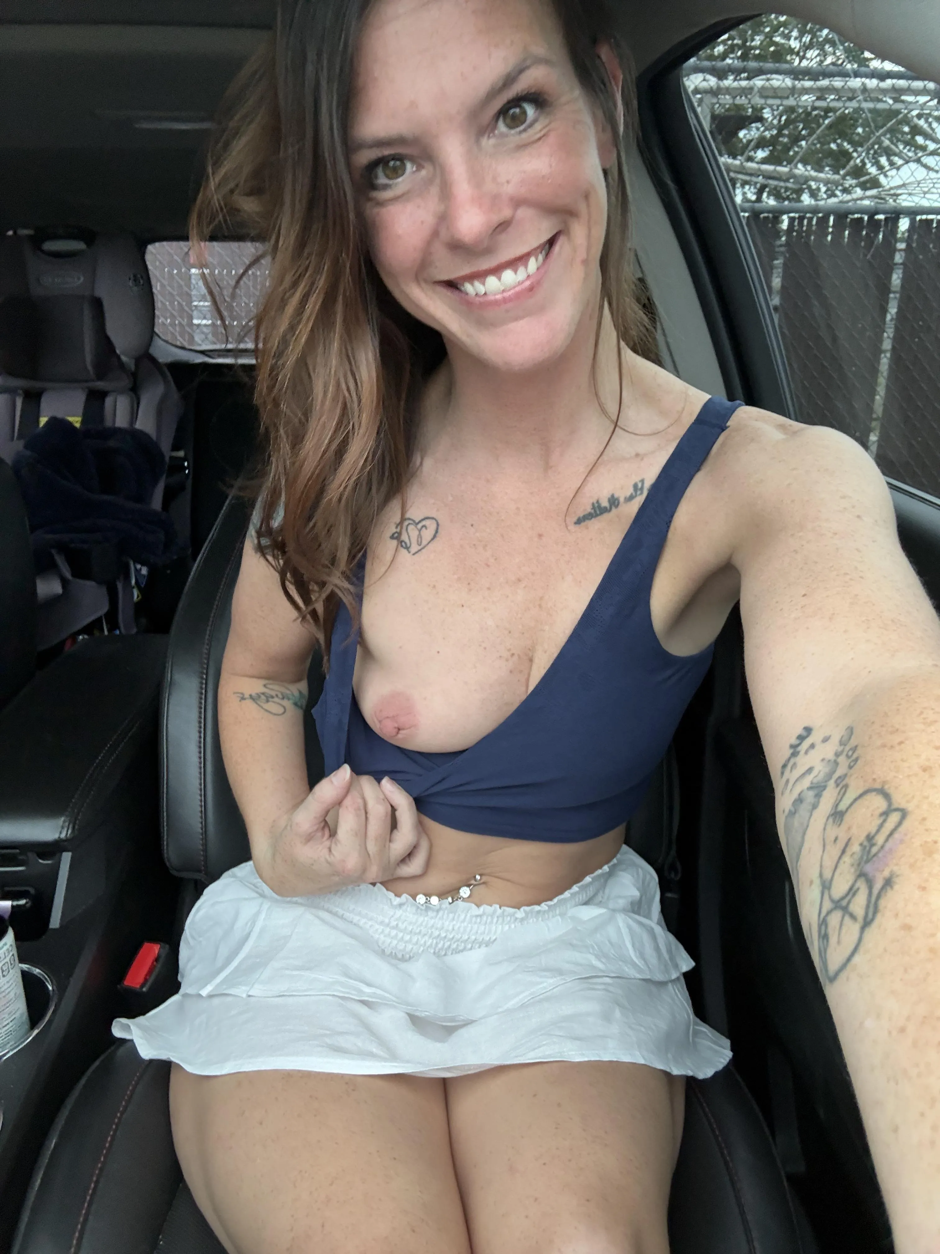 Freckles literally everywhere ya look