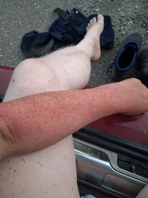 Got a little bit burnt today 🐉