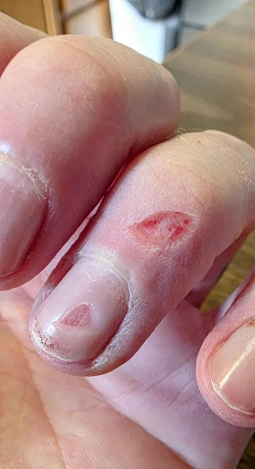 Managed to cut a chunk out of the middle of my nail bed.