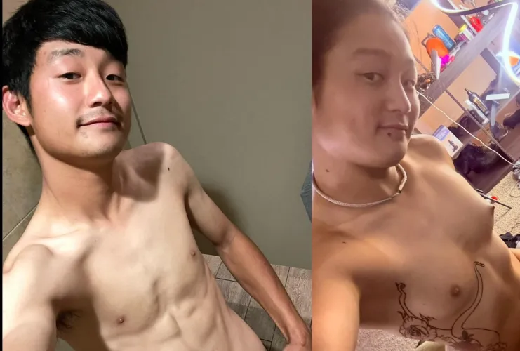 Face and breast changes 2 years and 2 months in