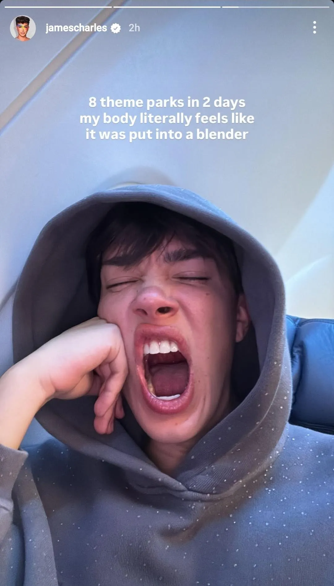 James Charles's pretty mouth from his new IG story