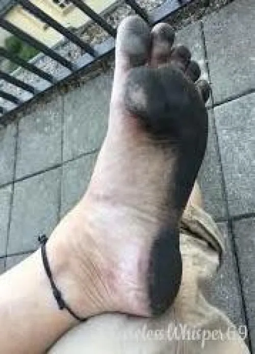 Just a 10~ minutes walk on asphalt made this