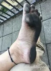 Just a 10~ minutes walk on asphalt made this