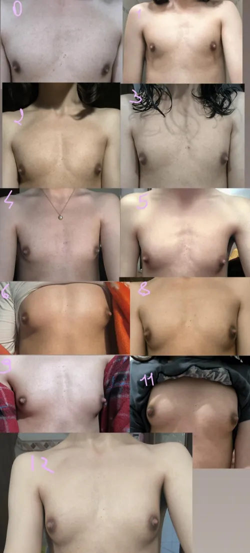 1 year on hrt timeline