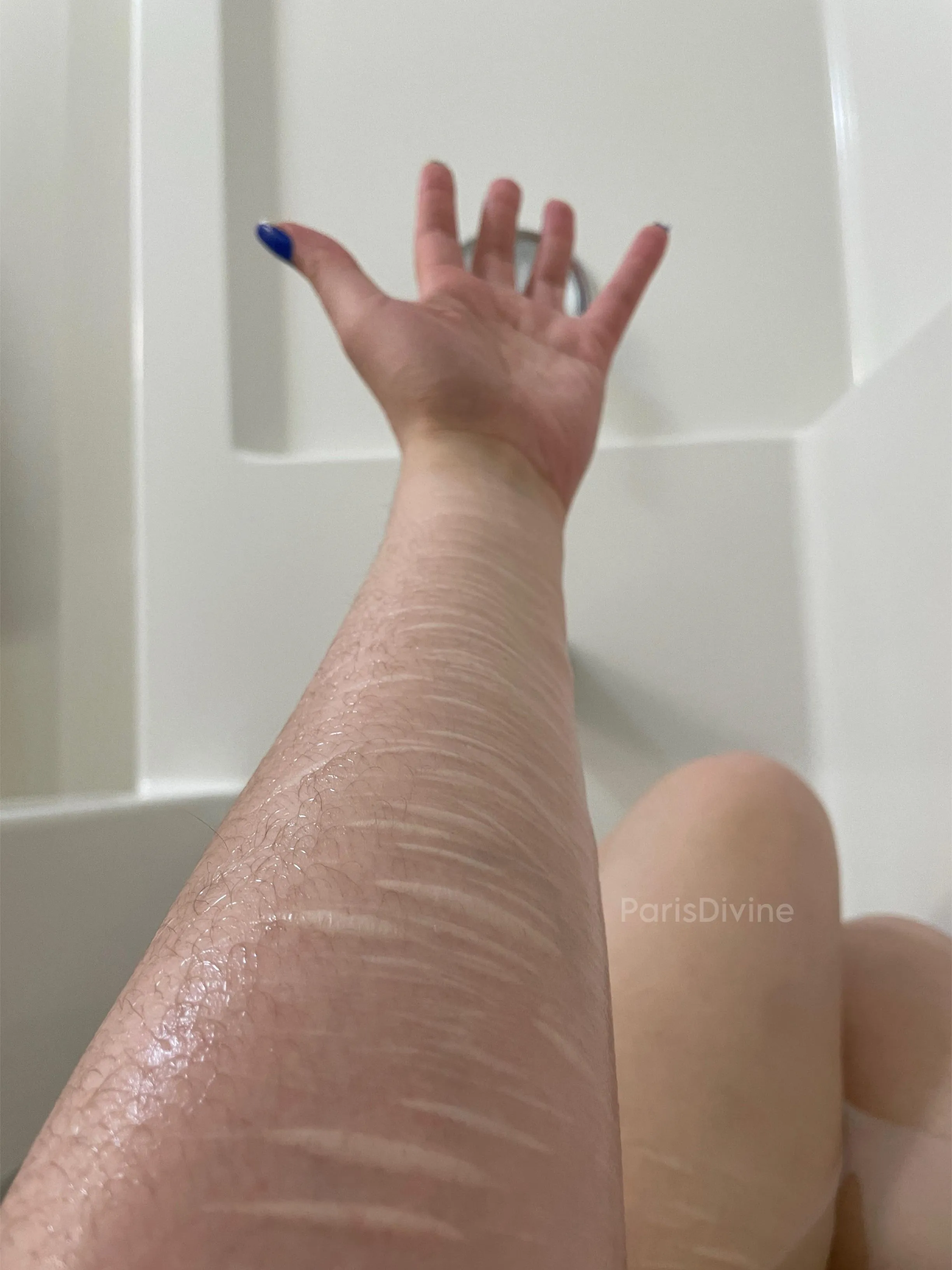 13 years of scars & counting 💓