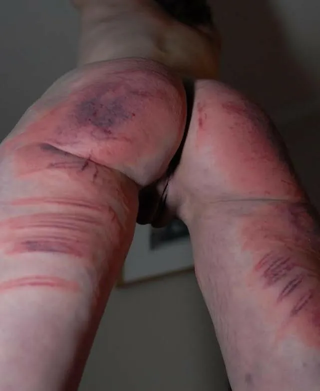 After Discipline. Before After Care.