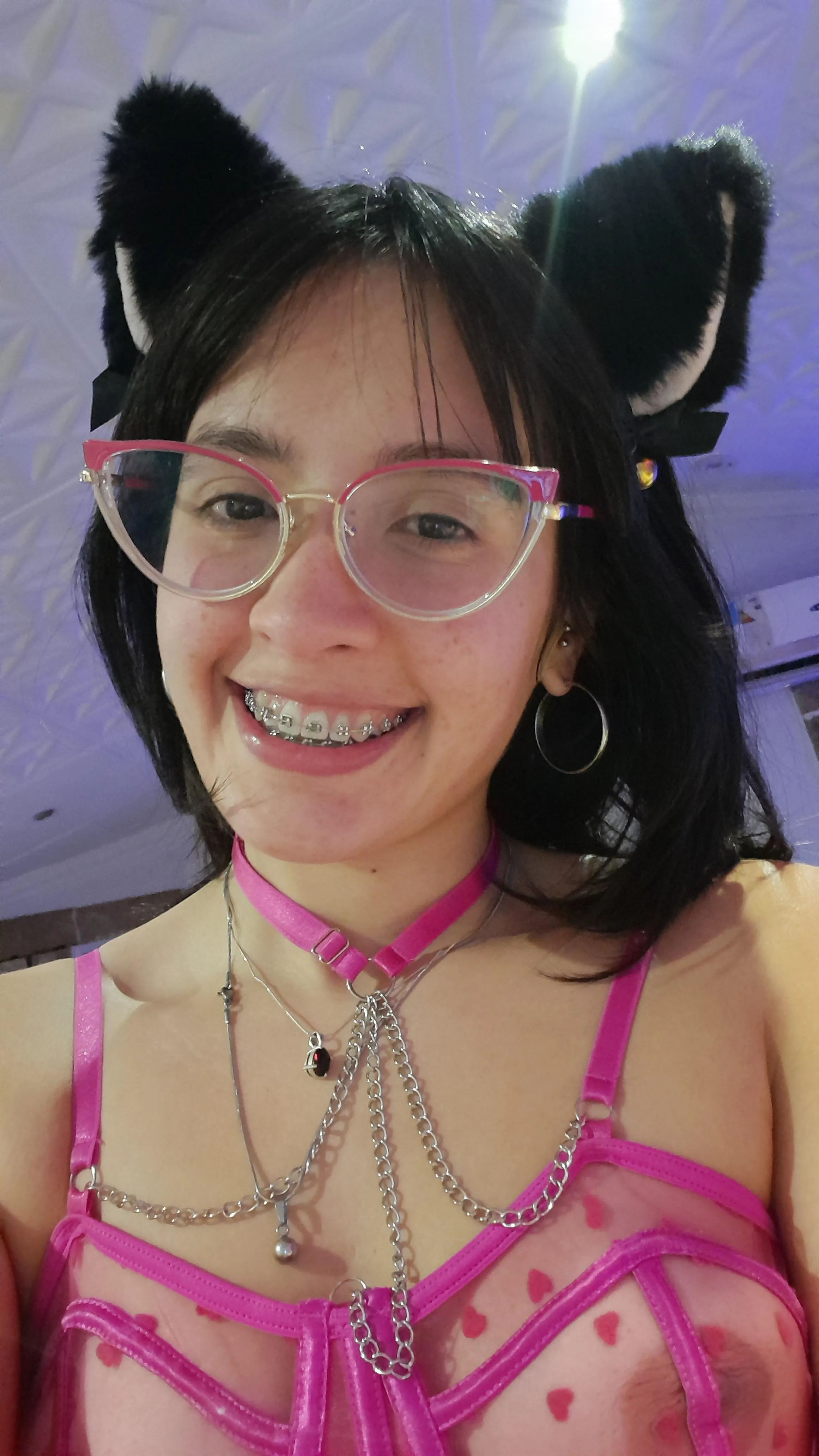 Kitten with braces looking for a loving and responsible owner