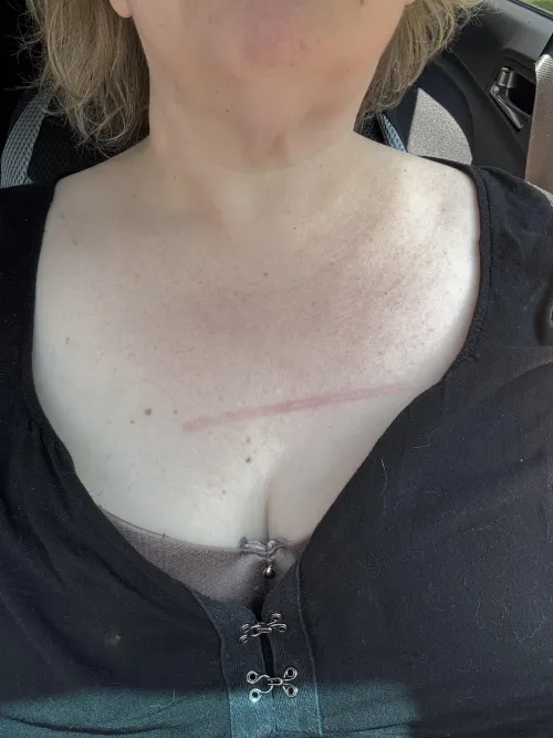 Maybe a cane to the chest isn’t  the best idea for tank top weather