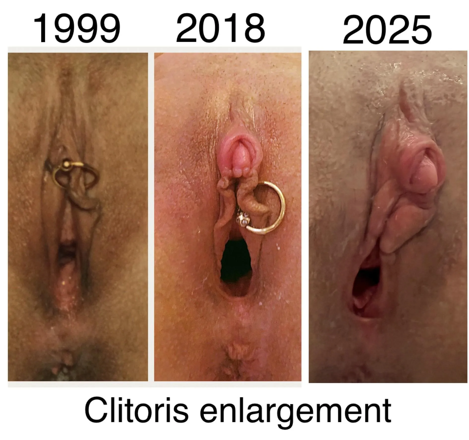 My clit enlargement journey