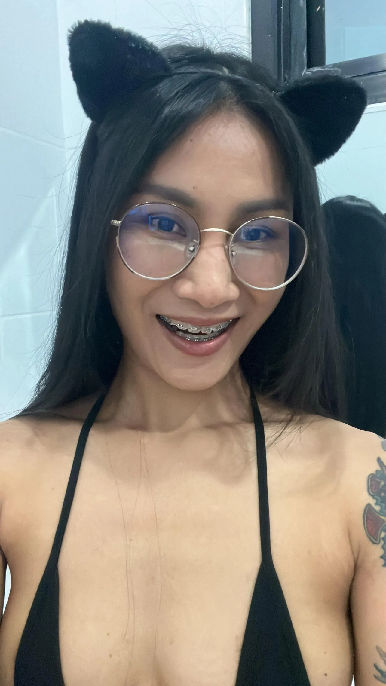 My cute braces are made to be covered in the right way, wanna help me out?