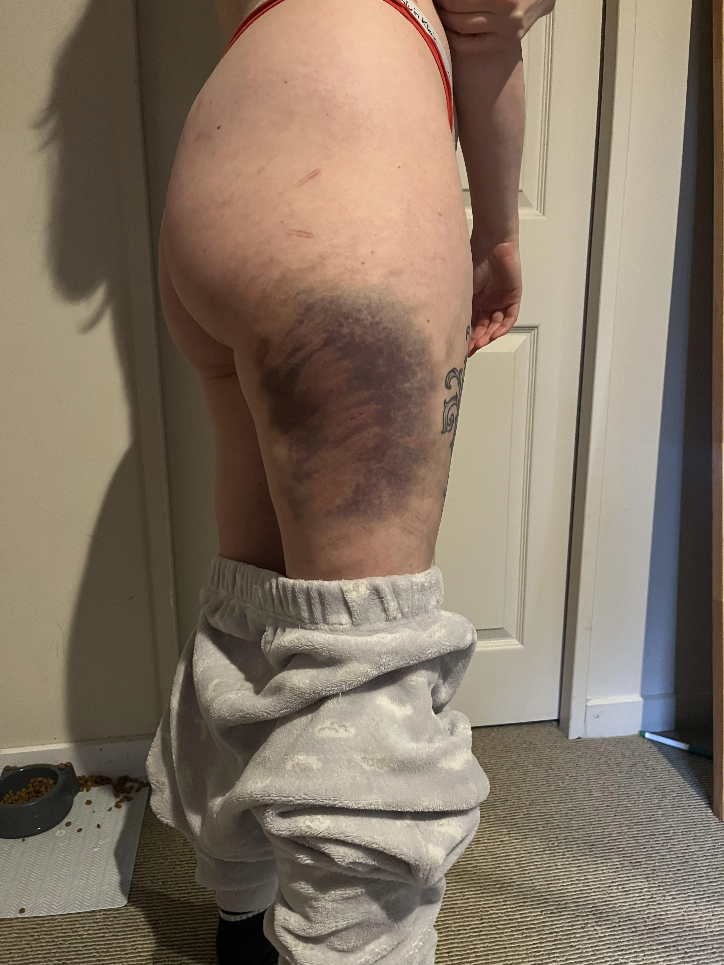 This was definitely the darkest it went! 3 days in from caning