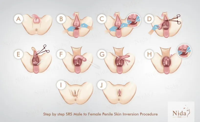 What I want most, that day will come when I will have it