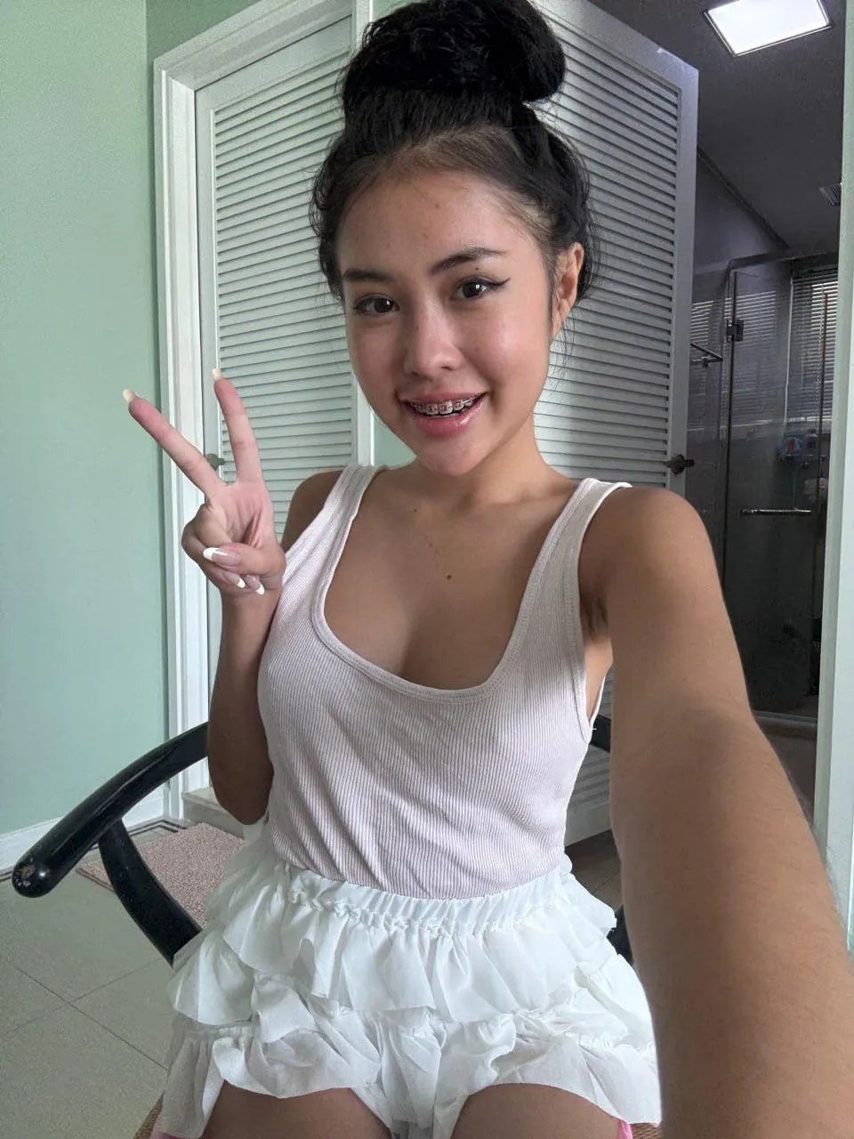 does my braces turn you on? 18f