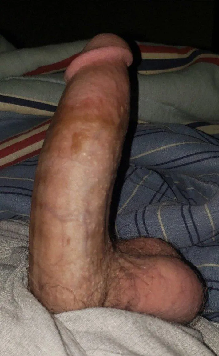 Mclennan : bwc looking to get drained