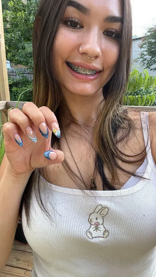 Which are cuter, my braces or my nails?
