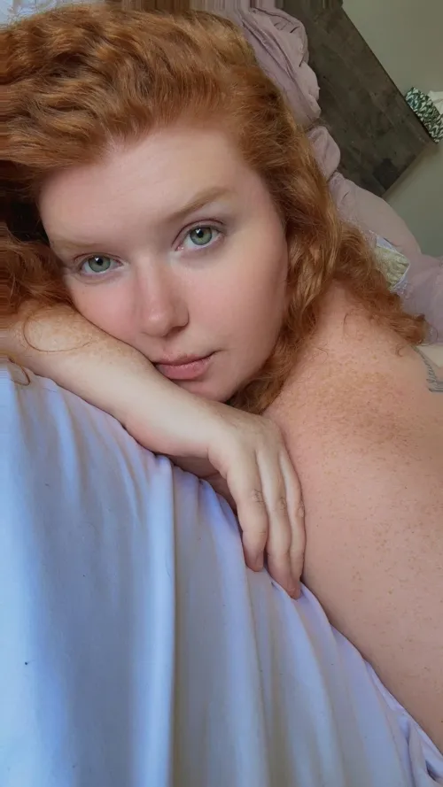 Freckles are out in full force for the summer [IRTR]