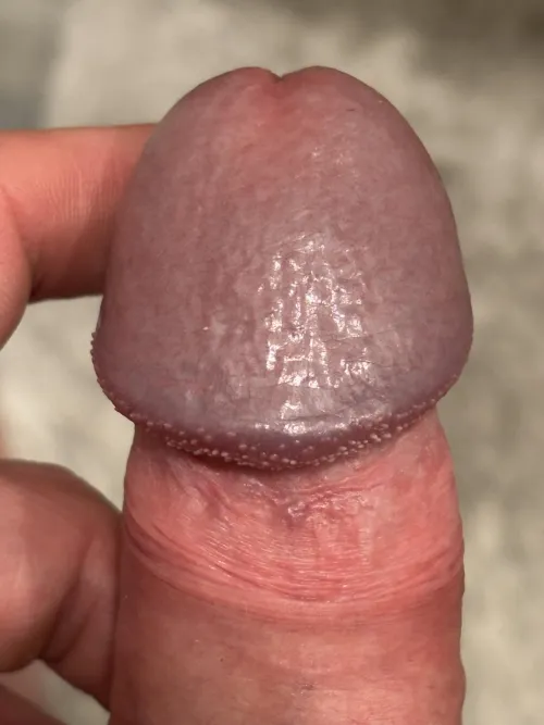 My purple glans, with some pearly penile papules